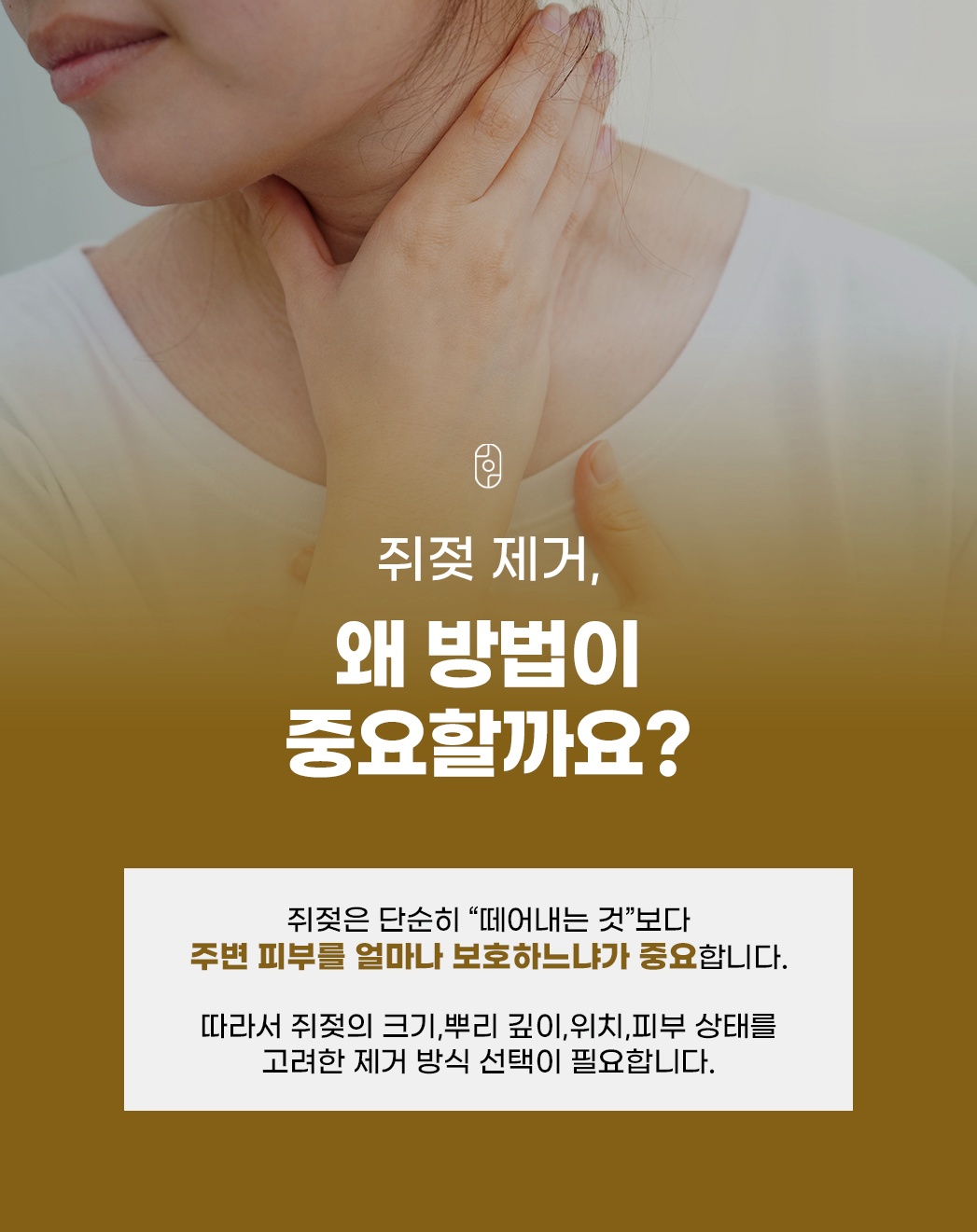 쥐젖 제거 방법이 중요한 이유