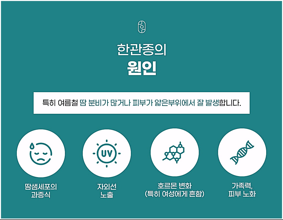 한관종의 원인, 땀샘세포 과증식·자외선·호르몬 변화·가족력 안내 그래픽