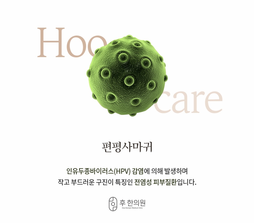 인유두종바이러스(HPV) 감염으로 발생하는 편평사마귀 정의 및 특징