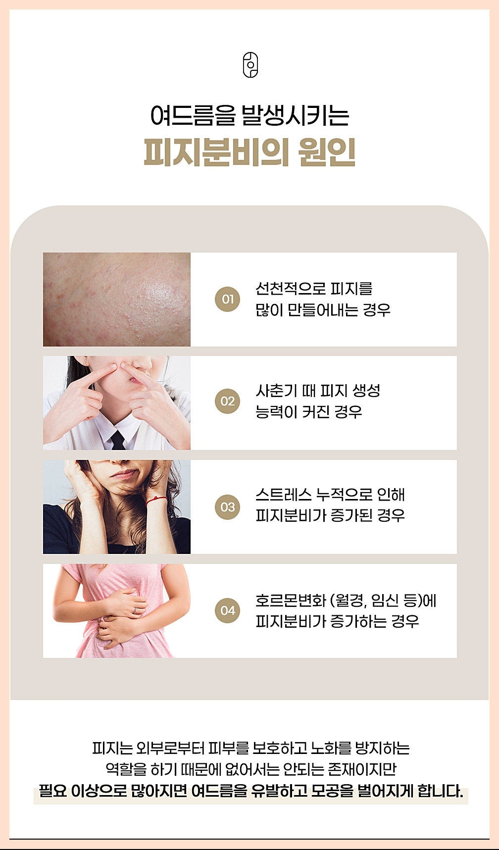여드름을 발생시키는 다양한 원인 이미지