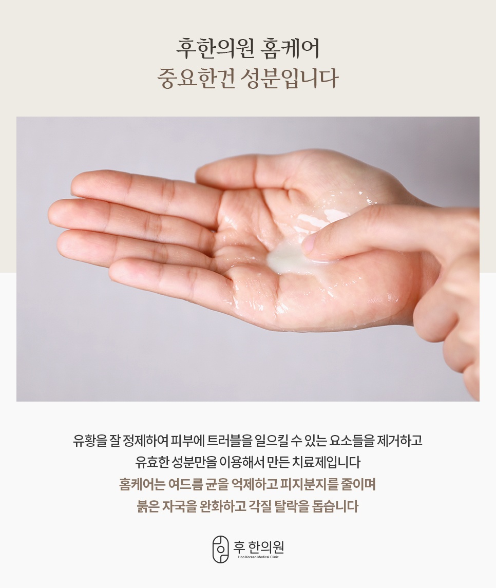손바닥에 덜어낸 크림 제형으로 설명하는 유황 정제 성분 홈케어 안내