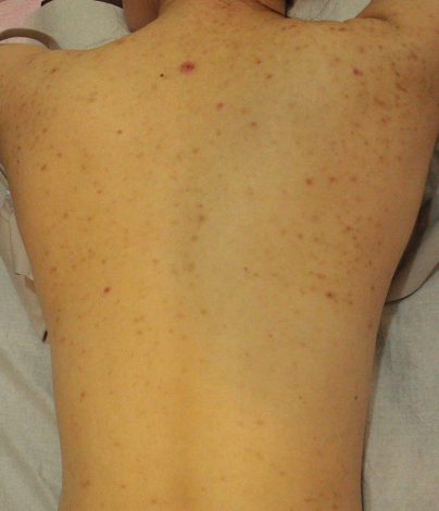 Before